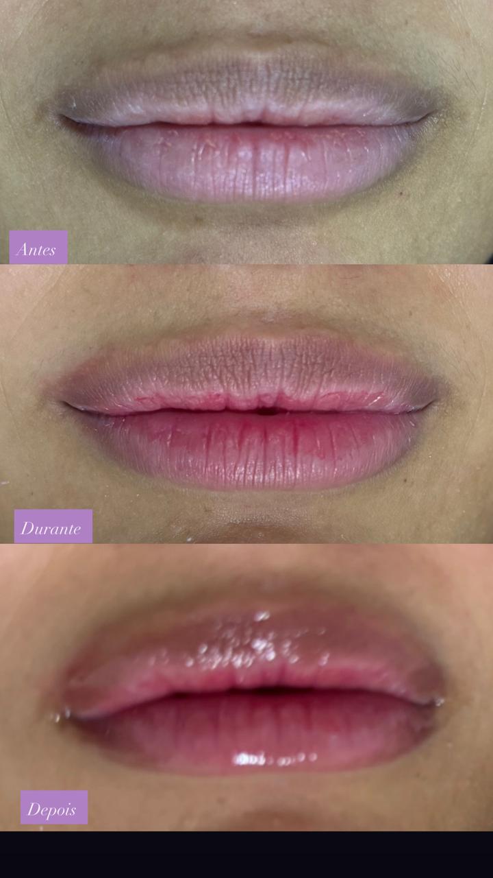 Hidra Gloss